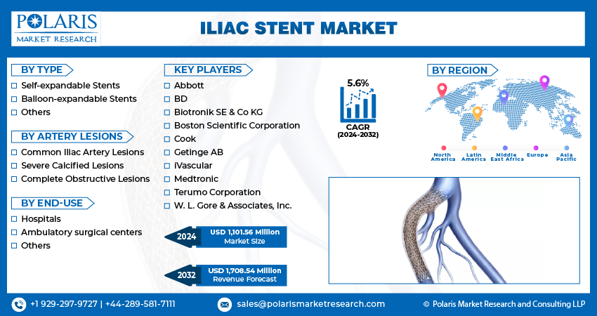 Iliac Stent Market size